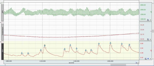 Research Ring data in AcqKnowledge - EDA Analysis